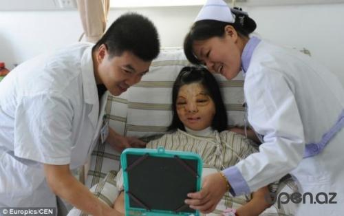 Китайские врачи сделали новое лицо девушке из ее груди