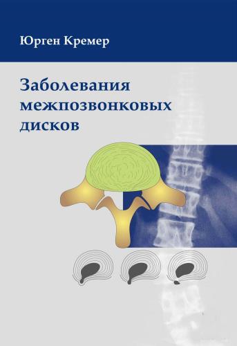 Кремер Ю - Заболевания межпозвонковых дисков  ( 2013) PDF,DjVu
